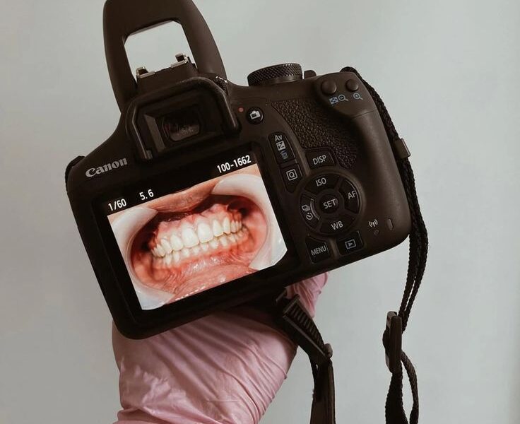 miedo-al-dentista-emora.png